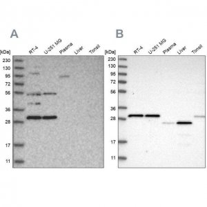 Anti-SCO1 antibody produced in rabbit 
