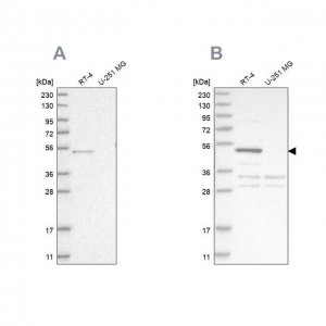 Anti-SCP2 antibody produced in rabbit 