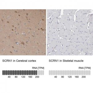 Anti-SCRN1 antibody produced in rabbit 