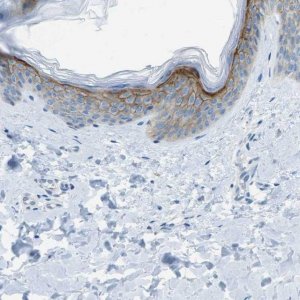 Anti-SDC1 antibody produced in rabbit 