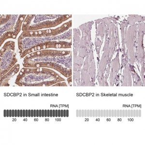 Anti-SDCBP2 