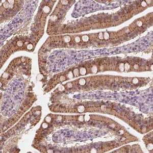 Anti-SDCBP2 