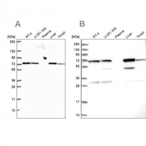 Anti-SDHA antibody produced in rabbit 