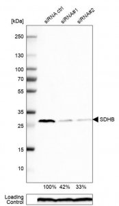 Anti-SDHB antibody produced in rabbit 