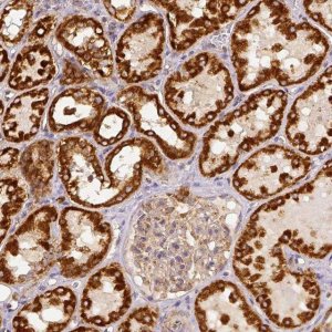Anti-SDHB antibody produced in rabbit 