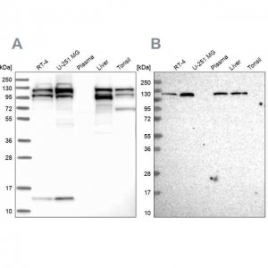 Anti-SEC24C antibody produced in rabbit 