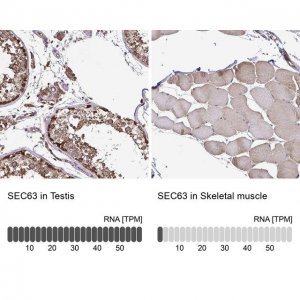 Anti-SEC63 antibody produced in rabbit 