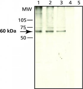 Anti-Seladin-1 (C-terminal) antibody produced in rabbit S8696-200UL