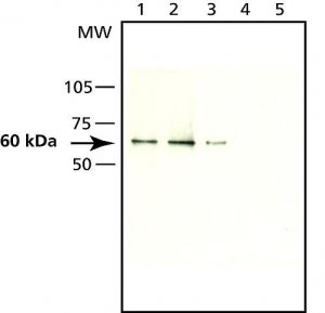 Anti-Seladin-1 antibody produced in rabbit S8571-200UL