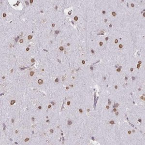 Anti-SEMA6B antibody produced in rabbit 