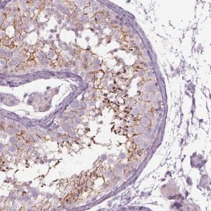 Anti-SEPT14 antibody produced in rabbit 
