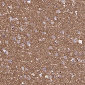 Anti-SEPT5 antibody produced in rabbit 
