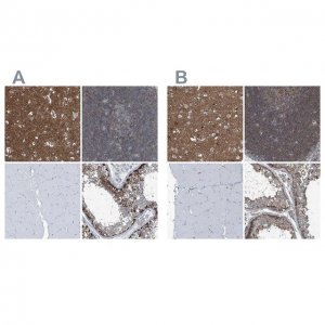 Anti-SEPT7 antibody produced in rabbit HPA023309-100UL