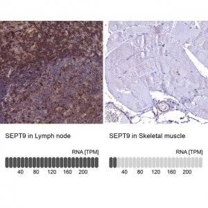 Anti-SEPT9 antibody produced in rabbit 