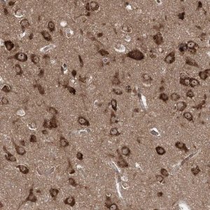 Anti-SERINC1 antibody produced in rabbit HPA035738-100UL