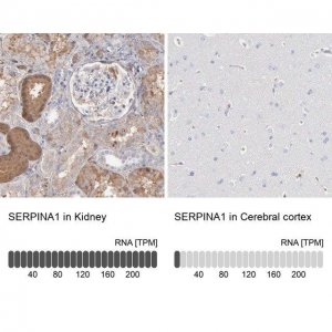 Anti-SERPINA1 antibody produced in rabbit 