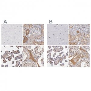 Anti-SERPINA1 antibody produced in rabbit 