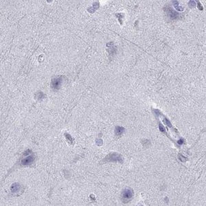 Anti-SERPINA3 antibody produced in rabbit 