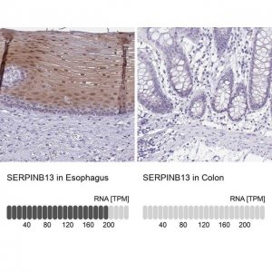 Anti-SERPINB13 antibody produced in rabbit 