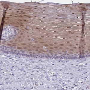 Anti-SERPINB13 antibody produced in rabbit 