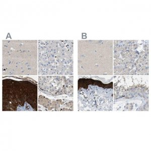 Anti-SERPINB5 antibody produced in rabbit 