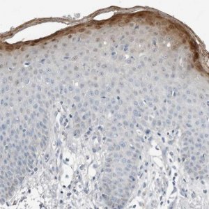 Anti-SERPINB7 antibody produced in rabbit 