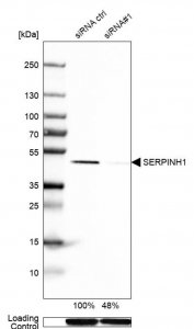 Anti-SERPINH1 antibody produced in rabbit HPA029198-100UL