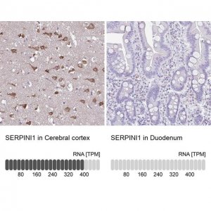 Anti-SERPINI1 antibody produced in rabbit 