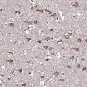 Anti-SERPINI1 antibody produced in rabbit 