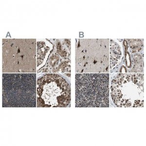 Anti-SERTAD2 antibody produced in rabbit 