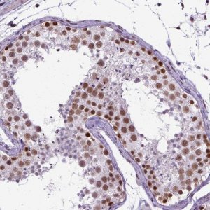 Anti-SETD1A antibody produced in rabbit 
