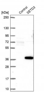 Anti-SETD3 antibody produced in rabbit HPA003639-100UL