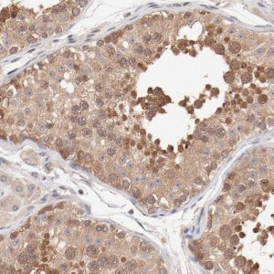 Anti-SETD3 antibody produced in rabbit HPA003639-100UL