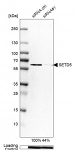 Anti-SETD5 antibody produced in rabbit 