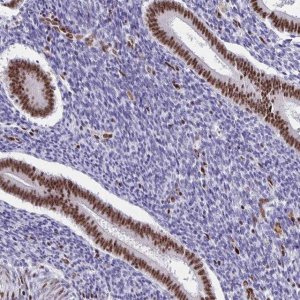 Anti-SETD5 antibody produced in rabbit 