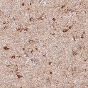 Anti-SEZ6L2 antibody produced in rabbit 