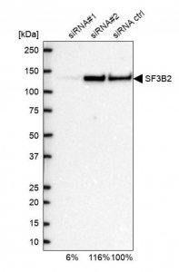 Anti-SF3B2 antibody produced in rabbit HPA045028-100UL