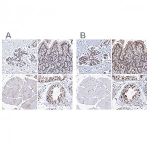 Anti-SF3B6 antibody produced in rabbit HPA034829-100UL