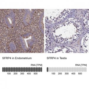 Anti-SFRP4 antibody produced in rabbit 