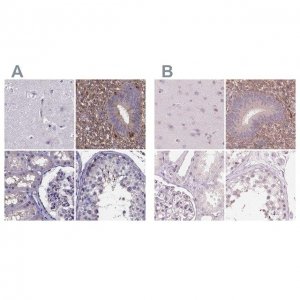 Anti-SFRP4 antibody produced in rabbit 