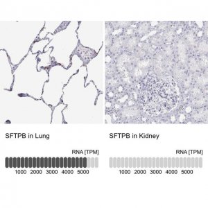 Anti-SFTPB antibody produced in rabbit 