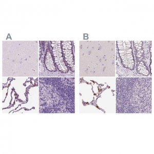 Anti-SFTPD antibody produced in rabbit 