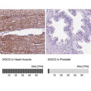 Anti-SGCG antibody produced in rabbit 