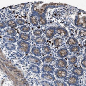 Anti-SGCZ antibody produced in rabbit HPA017585-100UL