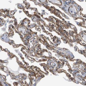 Anti-SGMS2 antibody produced in rabbit 