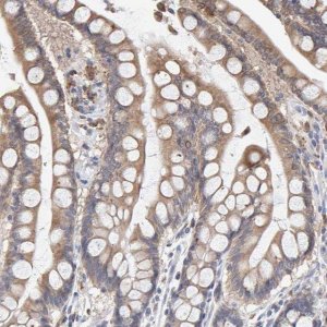 Anti-SGPL1 antibody produced in rabbit 