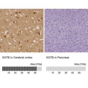 Anti-SGTB antibody produced in rabbit 