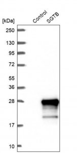 Anti-SGTB antibody produced in rabbit 