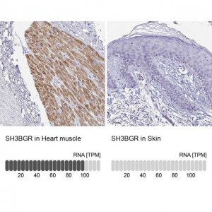Anti-SH3BGR antibody produced in rabbit 