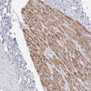 Anti-SH3BGR antibody produced in rabbit 